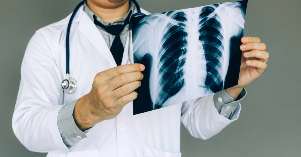 Doctor Checking an X-ray Film