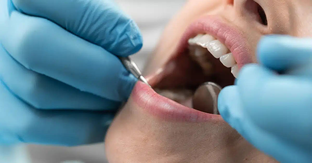 Dentist Examining Patient’s Teeth