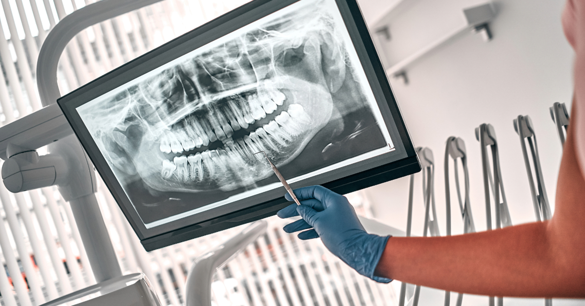 Dental professional reviewing X-ray in clinic