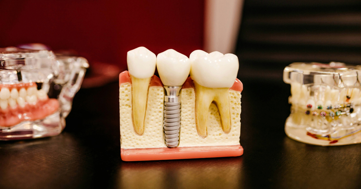 best dental clinic in Mussafah