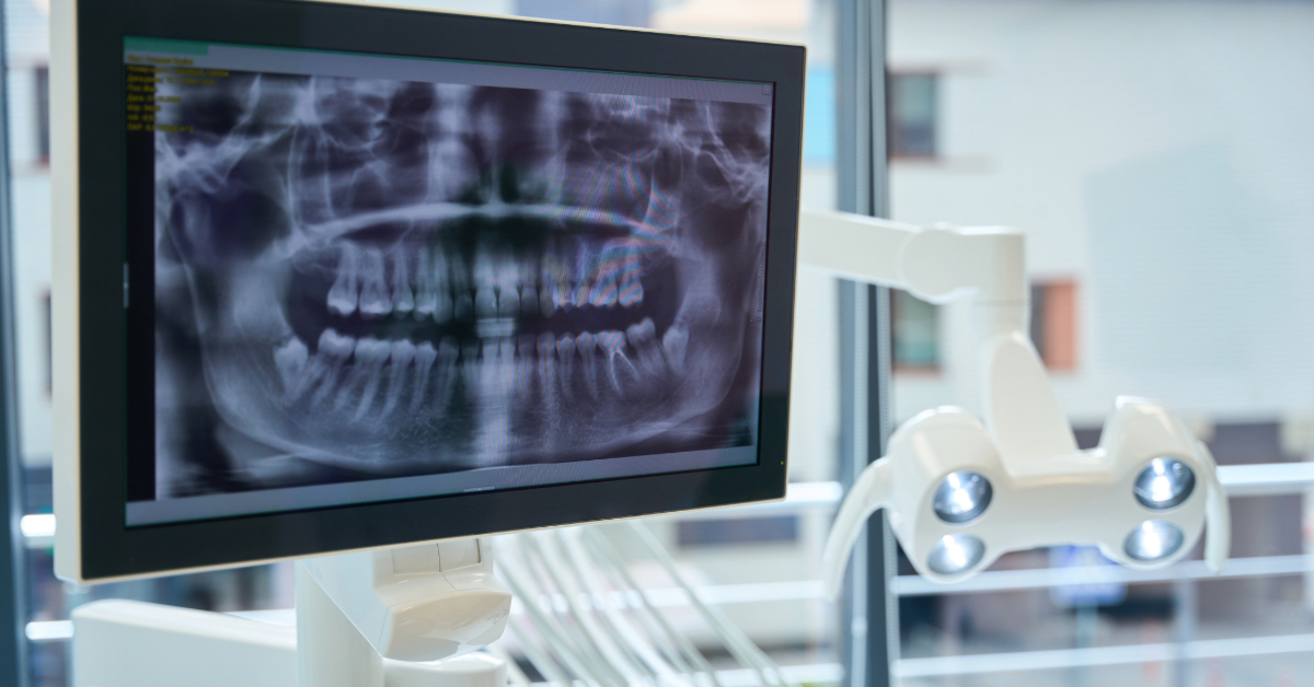 Monitor with the image of a dental x-ray