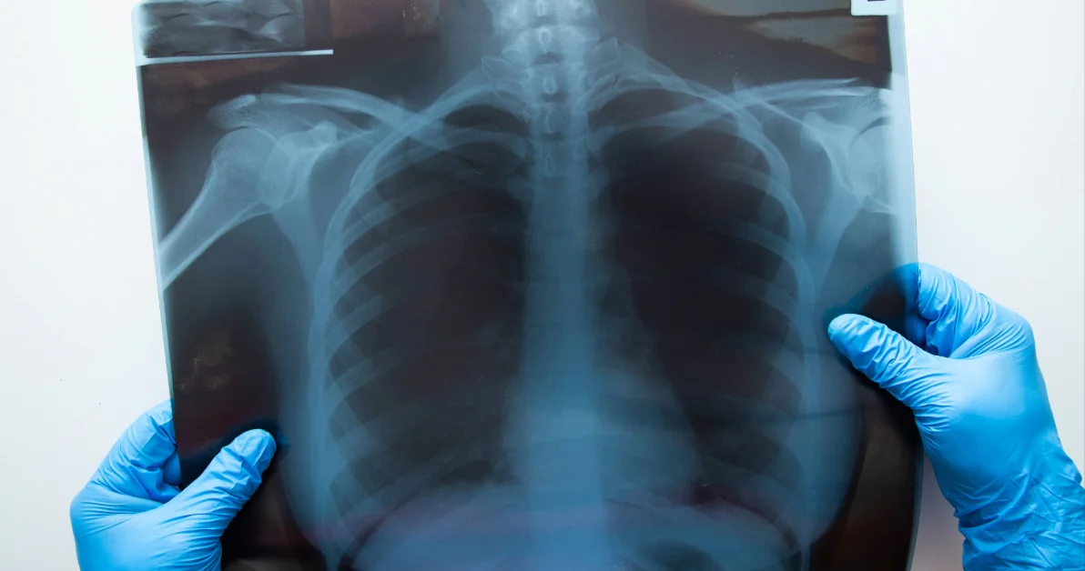 Medical doctor hand holding a x ray